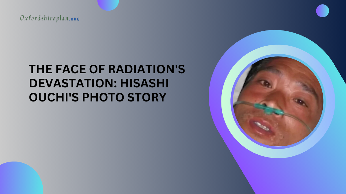 The Face of Radiation's Devastation: Hisashi Ouchi's Photo Story