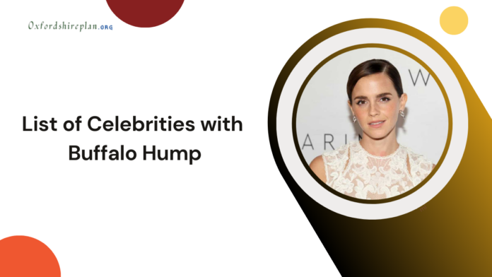 celebrities with buffalo hump